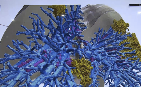 Coronavirus fight: AR, 5G and 3D modeling help doctors in teleconsultation